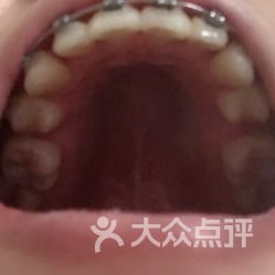 口腔健康無小事——走進華西口腔醫院的專業診療世界
